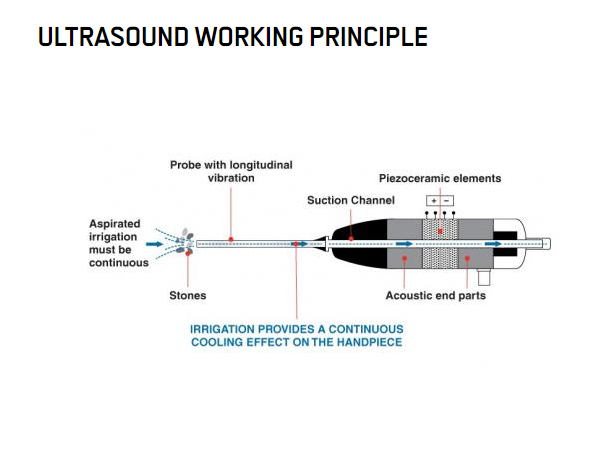 PZT -Material Piezo -Keramikring -Piezoceramic -Wandler f&uuml;r Ultraschall -Lithotripsie